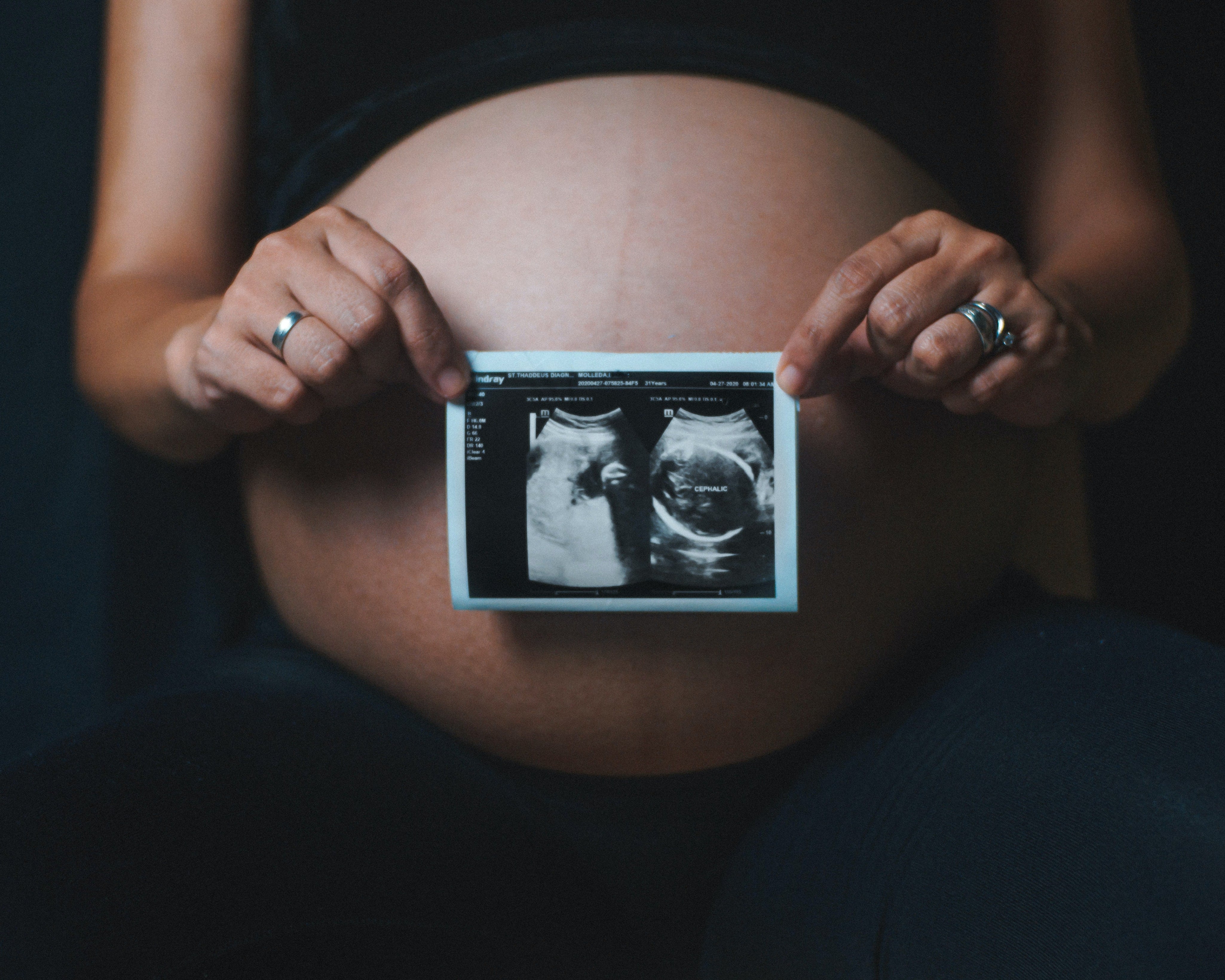 Obstetrician vs Gynaecologist: What's The Difference?