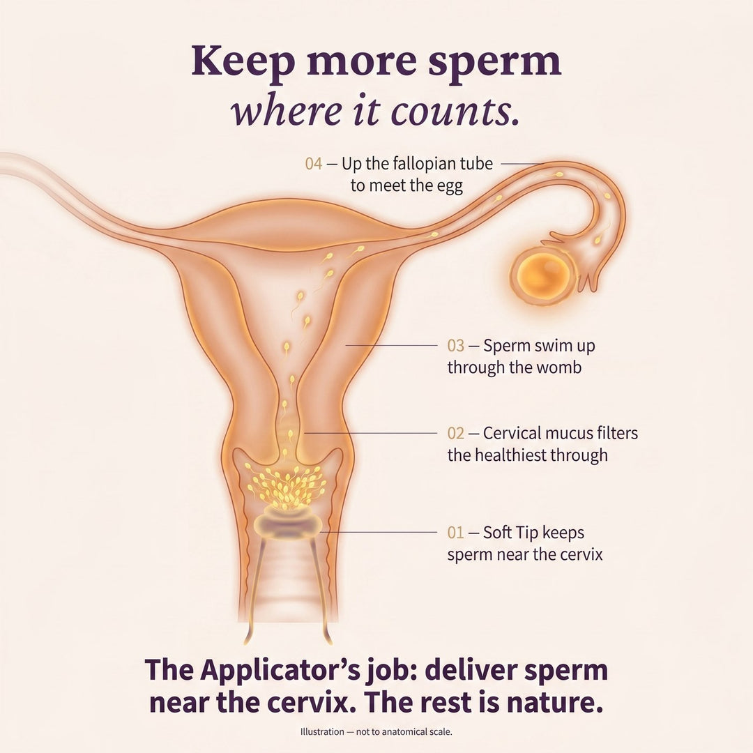 The Applicator delivers sperm near the cervix; cervical mucus filters the healthiest through